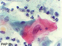 Das Bild zeigt PAPIII