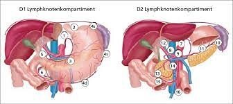 D1 und D2 Lymphknotenkompartiment / tbd D1 und D2 Lymphknotenkompartiment