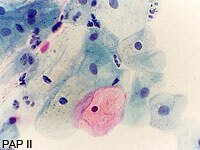 Das Bild zeigt PAPII