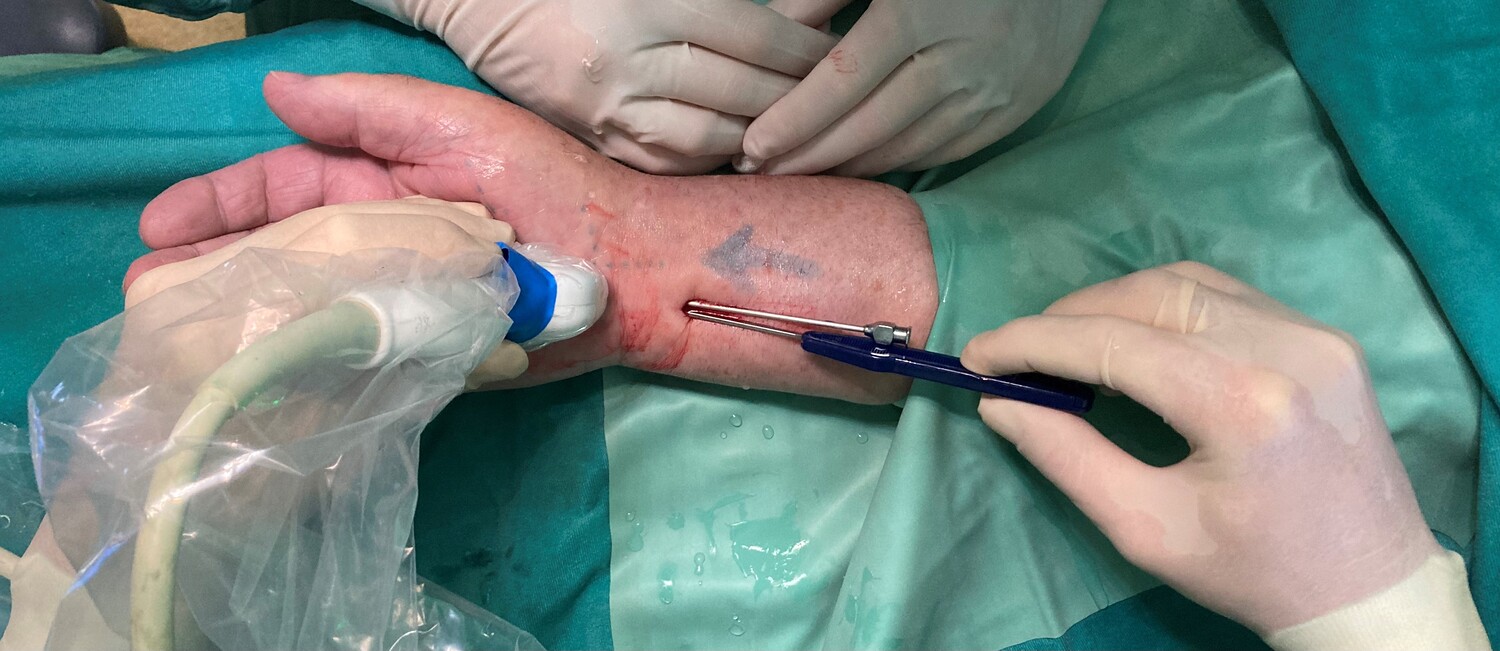 KARPALTUNNELSYNDROM / Barmherzige Brüder Graz KARPALTUNNELSYNDROM